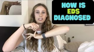 Hypermobile EDS Diagnostic Criteria 2017 [upl. by Oisor953]