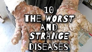 TOP 10 strangest and rare diseases that affected people around the world [upl. by Andersen]