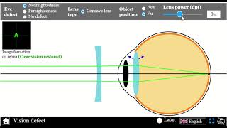 Vision Defect Simulator Myopia amp Hypermetropia [upl. by Ludvig]