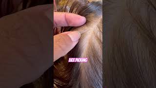 Lice picking l lice removal l small business hair lice shorts hairvideo [upl. by Aiuqenehs]