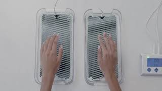 Treat Sweaty Hands with Dermadrys Iontophoresis Machine [upl. by Braasch]