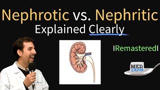 Nephrotic vs Nephritic Syndrome Proteinuria Hematuria Casts [upl. by Giorgio626]