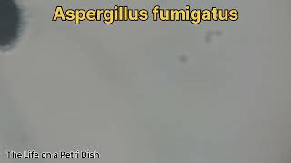 Aspergillus niger fumigatus and flavus [upl. by Lewej]