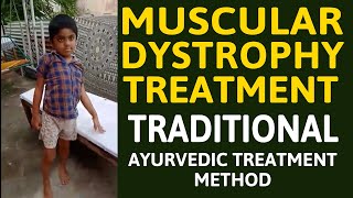 muscular dystrophy treatment in india  myopathy treatment in india [upl. by Nalehp]