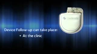 What is an Implantable Cardioverter Defibrillator ICD [upl. by Nnahoj]