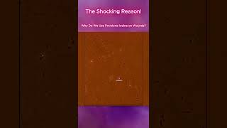 Why Do We Use PovidoneIodine on Wounds [upl. by Dun]