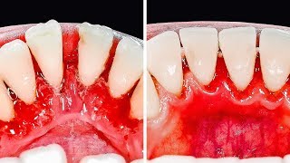 30 ASTUCES POUR LES DENTS QUE TU DOIS CONNAÎTRE [upl. by Valle904]