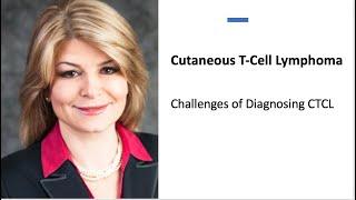 Challenges of Diagnosing CTCL Chapter 1 [upl. by Hermia]