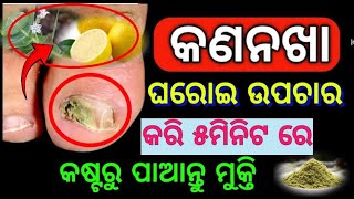 କଣନଖ ର ଘରୋଇ ଉପଚାରkana nakha treatment medicine odia gharoi upachar kana nakha hele kn kariba bn [upl. by Hanleigh]