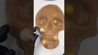 One Minute of infected Skull Mochi Pimple Popping Satisfying ASMR viral fyp asmr [upl. by Nylcoj]