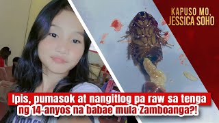 Ipis pumasok at nangitlog pa raw sa tenga ng 14anyos na babae  Kapuso Mo Jessica Soho [upl. by Amzaj]