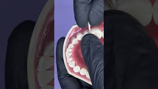 Class II cavity preparation tips and tricks Protecting the adjacent dentist dentistry [upl. by Hanahs]