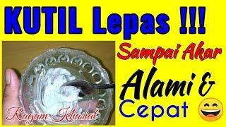 Cara Mencabut Kutil Sampai Akarnya  Alami Dan Cepat [upl. by Ardnas]