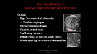 Fetal Abdomen ultrasound Dr Ahmed Esawy [upl. by Berg95]