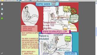 SESSIONS for NURSES 10  CARDIOGENIC AND SEPTIC SHOCK [upl. by Perrie515]