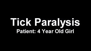 Tick Paralysis in a 4 Year Old Girl [upl. by Eniamrahs10]