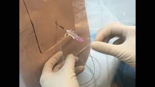 Neuraxial Task Trainer Demonstration  Epidural Anesthesia [upl. by Ahsimat452]