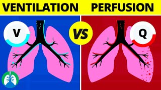 VentilationPerfusion VQ Ratio  Quick Medical Overview [upl. by Redmer]