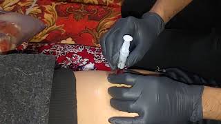 intramuscular injection injection into the gluteal muscle [upl. by Afas29]