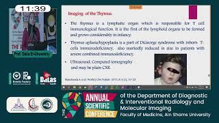 Phenotypic clues to inborn errors of immunity [upl. by Barnaba]