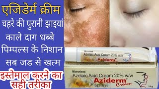 AZIDERM CREAM REVIEW चहरे के काले दाग धब्बे झाइयांएकने पिम्पल्स सब जड से खत्म करने की क्रीम [upl. by Jeromy]