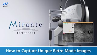 How to Capture Unique Retro Mode Images  NIDEK Mirante SLOOCT [upl. by Ulu]