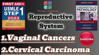 Usmle step 1Vaginal tumorsCervical carcinoma from PathomaReproductive system pathologyUrduHindi [upl. by Arinaj]