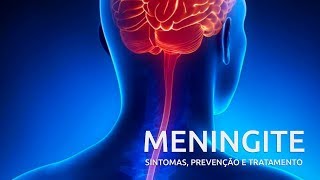 Meningite – sintomas prevenção e tratamento  Sua Saúde na Rede [upl. by Eicak]