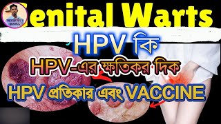 HPV কি HPV এর ক্ষতিকর দিক। HPV এর প্রতিকার। HPV এর প্রতিরোধ । HPV vaccine What is hpv [upl. by Erdnael743]