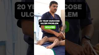 Miracle Cure for Chronic LEG ULCER shortsviral varicoseveinstreatment IVUS [upl. by Ardnoid]