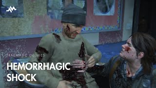 Hemorrhagic Shock in Traumatic Injuries  The Last of Us [upl. by Oznarol]