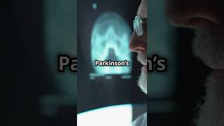 Shocking Causes of Parkinson’s You Need to Know [upl. by Amekahs]