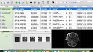 10 How to Transfer Cases from Osirix to an External Hard Drive [upl. by Curry612]