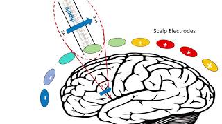 EEG  Electrical Brainwaves [upl. by Banks59]