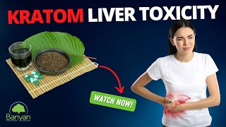 Kratom Liver Toxicity [upl. by Sibel]