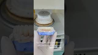 Full zirkon dentist goviral dentistry dentalclinic smiledentist cosmeticdentistry dentist [upl. by Fini]