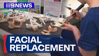 3D printing technology transform lives of head and neck cancer patients  9 News Australia [upl. by Aschim]