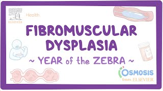 Fibromuscular dysplasia Year of the Zebra [upl. by Lerud]