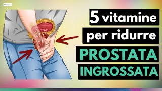 5 migliori VITAMINE per ridurre la PROSTATA ingrossata [upl. by Rozanne]