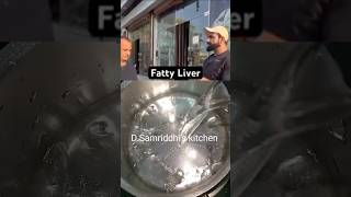 Fatty liver Detox water Fitness Coach Nitesh Sonis Recipe  shorts foodfitnesshomeremedies [upl. by Sokram]