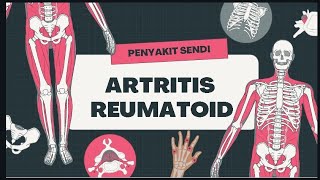 Biologi Kelas 11  Penyakit Sendi Arthritis Reumatoid [upl. by Gunther]