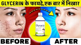 सर्दियों में Glycerine use करने के नुकसान और फायदे  Glycerin Benefits for Skin [upl. by Collen]