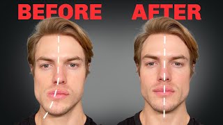 How to Fix Asymmetrical Jaw amp Face FOREVER [upl. by Enilauqcaj]