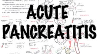 Acute Pancreatitis  Overview signs and symptoms pathophysiology investigations treatment [upl. by Avihs]