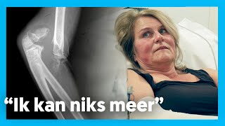 BEIDE ELLEBOGEN GEBROKEN  Op de spoed [upl. by Cavanagh]