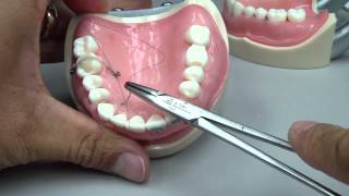 Root Coverage  Sling Suture [upl. by Camroc]