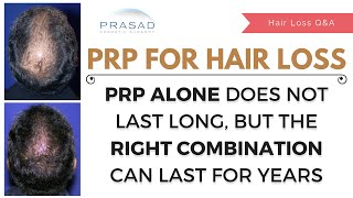 Monthly PRP Hair Loss Injections Have Limited Results  Combo Treatment Lasts Years with 1 Treatment [upl. by Gillett]