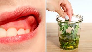 Heal Your Tooth Abscess  Dental Infection Naturally [upl. by Heathcote]