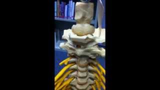 Quick Demonstration of C1C2 Instability in EhlersDanlos [upl. by Ecarg346]