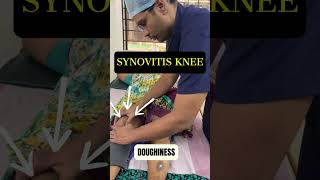 Knee swelling  Synovitis kneepain osteoarthritis shorts [upl. by Kinghorn]